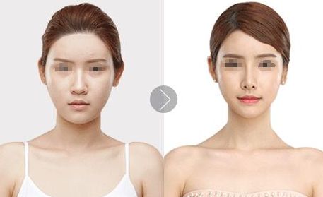 揚州有哪些專業(yè)的鼻整形醫(yī)院？