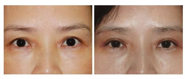 上海最好的整形醫(yī)院推薦