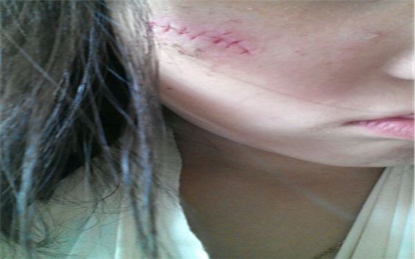 廣州哪家醫(yī)院做美容整形好