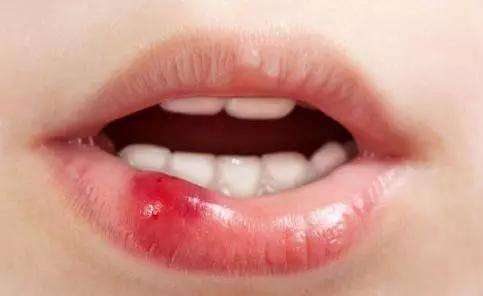 九院余力做吸脂，美麗塑身真的有效嗎？