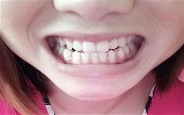 寧波星范吸脂是否值得信賴？有哪些值得注意的地方？