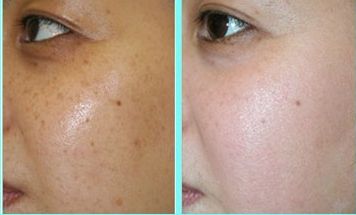 合肥整形醫(yī)院哪家做眼睛好？綜合評(píng)價(jià)告訴你最好的選擇