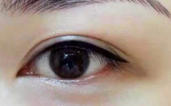 青島哪家醫(yī)院專(zhuān)業(yè)治療紅血絲效果好？