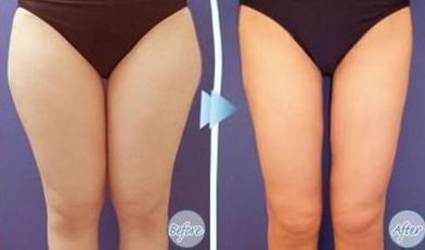 太原祛黃褐斑哪家醫(yī)院好？專家推薦這幾家醫(yī)院！