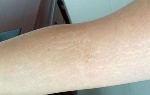 武漢磨骨醫(yī)院協(xié)和榜首！詳情揭秘公立醫(yī)美機構(gòu)回歸出圈！