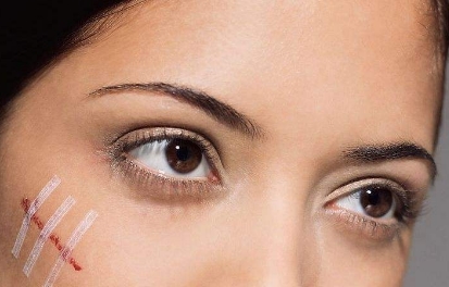 正畸用自鎖托槽技術(shù)與牙齒矯正價格相差多少？