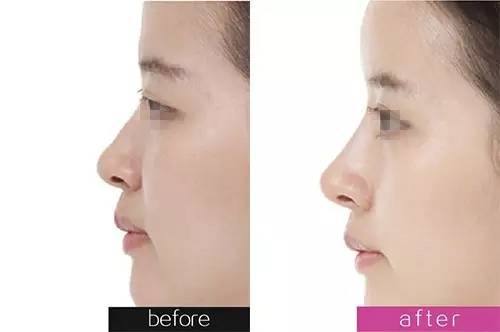 鄭州美萊和虎珂整形到底哪個(gè)更值得選擇？資歷、口碑、網(wǎng)友評(píng)價(jià)一覽對(duì)比真相如何？