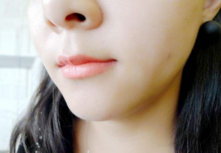 南京有哪些專業(yè)醫(yī)院可以有效治療黑頭？