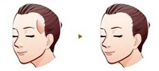 美容冠價格是如何受影響的？為什么一顆需要多少錢？