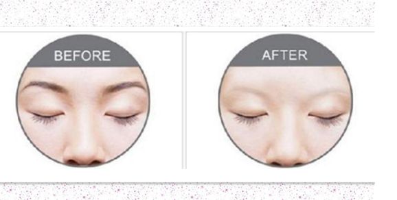 2023年最新青島隆胸醫(yī)院報告——全面解析！