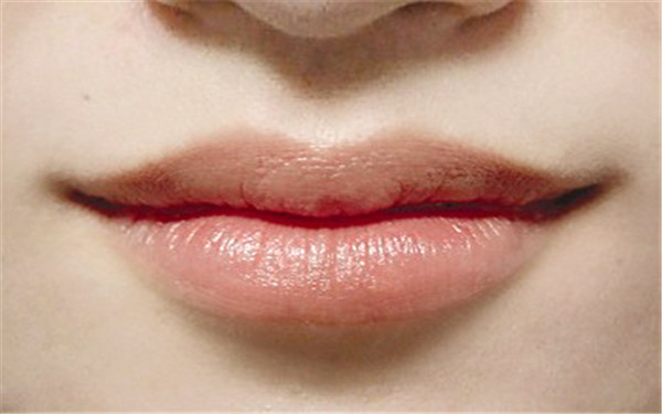 邯鄲哪些整形醫(yī)院的拉皮手術(shù)效果好？毫無副作用呢？