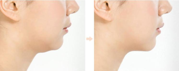 2023年安徽線雕修復(fù)醫(yī)院TOP10強(qiáng)口碑！哪家性價(jià)比高？