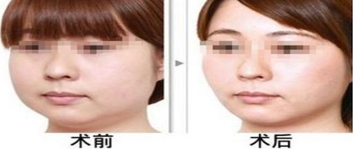 貴陽十大正規(guī)拉皮整形醫(yī)院排名匯總