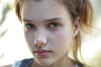 北京安貞醫(yī)院光子嫩膚效果如何？值得嘗試嗎？