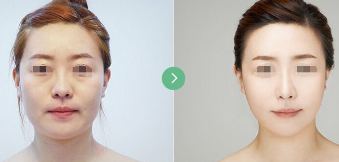 重慶松山醫(yī)院唇腭裂修復(fù)熟練醫(yī)生推薦!