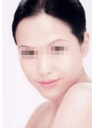 上海魯南楊明鼻部整形醫(yī)生資料簡(jiǎn)介及手術(shù)價(jià)格、口碑點(diǎn)評(píng)