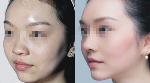 北京哪家醫(yī)院去唇紋效果好？排名前10強揭秘