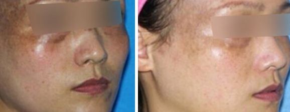 鄭州胸部注射填充值得信賴的十大醫(yī)療整形醫(yī)院精選