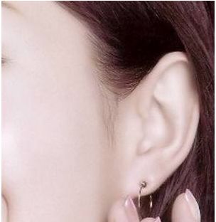 中山最贊脂肪填眼角紋醫(yī)院，技術(shù)秒殺雙眼皮