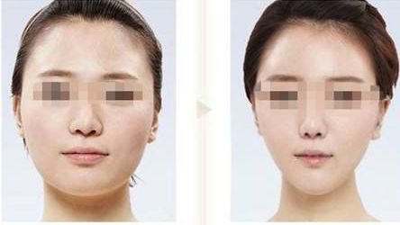 鄭州點(diǎn)陣祛老年斑醫(yī)院口碑實(shí)力榜單