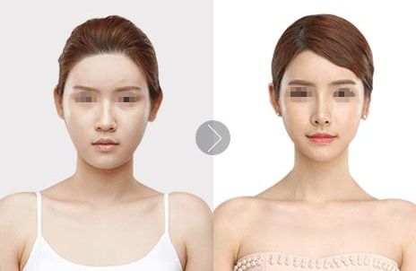 長沙市頂尖微整形醫(yī)療機構排行榜出爐