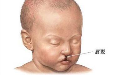 廣東哪家醫(yī)院做吸脂效果好？