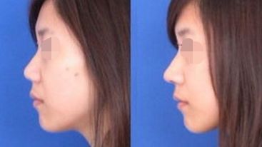 【2024】唐山最受歡迎的整容醫(yī)院排行榜公布！