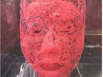 珠海什么醫(yī)院治療痣效果好，該怎樣選擇