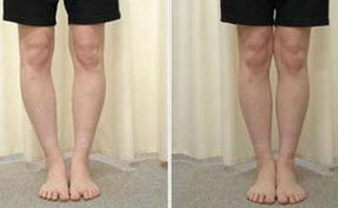 北京延世眼部整形技術(shù)有哪些？