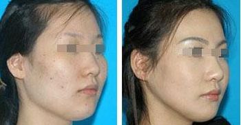 桂林整形醫(yī)院，哪家排名前3？