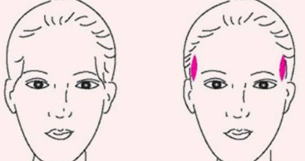 濱州有沒有好的妊娠紋修復(fù)機構(gòu)？