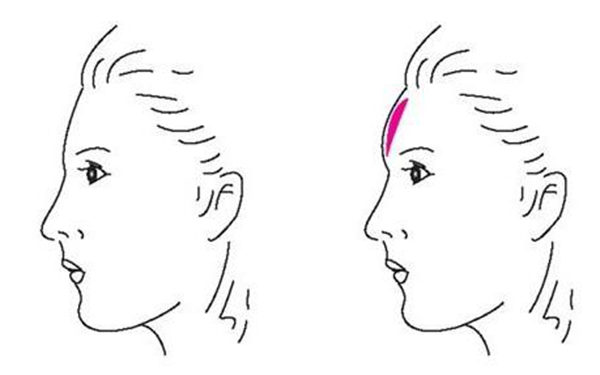 激光嫩膚手術前需要做哪些準備工作？