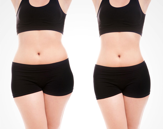 廣州哪家整形醫(yī)院對生長紋切除有豐富經(jīng)驗？2023年最新推薦！