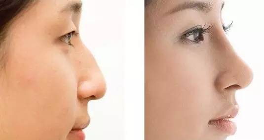 北京煤醫(yī)醫(yī)療美容醫(yī)院的醫(yī)生有哪些擅長項目？醫(yī)院的技術有何亮點？