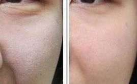 邵陽市哪里能找到靠譜的豐胸醫(yī)院？