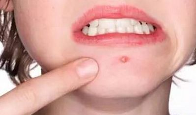 2023年西安地區(qū)優(yōu)質(zhì)雙眼皮手術(shù)醫(yī)院匯總