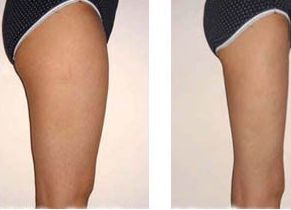 佛山整形醫(yī)院用戶評價引爆！排名第一的醫(yī)療機構(gòu)究竟是哪家？