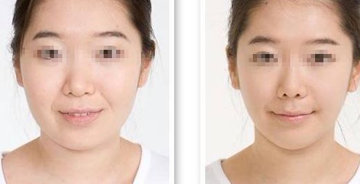 淮安眼角動(dòng)態(tài)紋醫(yī)療整形醫(yī)院榜單：實(shí)力排行前10