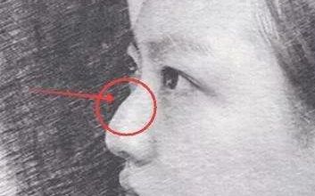 廈門玻尿酸整形醫(yī)院推薦【2024年最新】