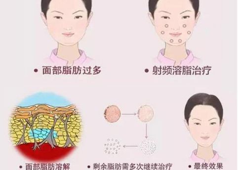 河南哪家私密整形醫(yī)院排名前八綜合口碑好