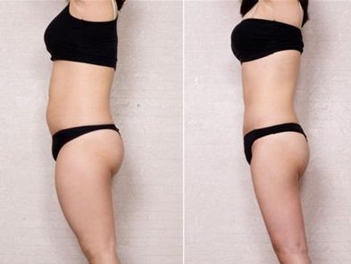 上海醫(yī)美欣賞！不可錯(cuò)過(guò)的整容醫(yī)院是哪家？探尋！