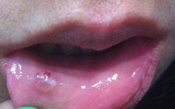 2023年值得選擇的鄭州雙眼皮修復(fù)醫(yī)院口碑TOP10