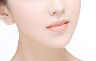 寧波藝星脂肪填充好用嗎？奇跡可期？