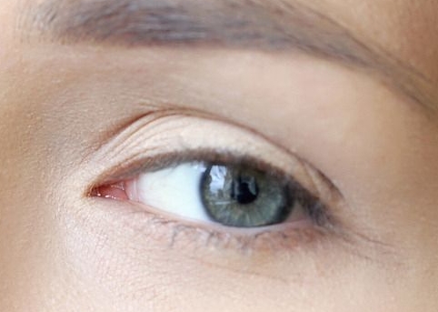 2023年武漢去除法令紋排行榜公布，十大整形醫(yī)院爭鋒相對