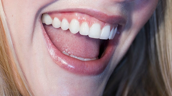 揭秘武漢開眼角口碑佳的十大美容院，幫您打造電眼魅力