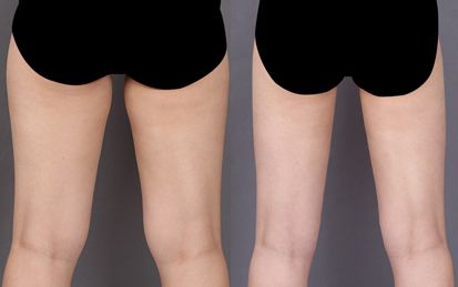 三亞哪家醫(yī)院做鼻子好？頂級整形醫(yī)院推薦大揭秘