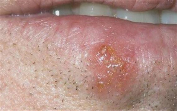 吉安鼻部修復(fù)需要去哪里醫(yī)院可以做？如何選擇醫(yī)院才能得到滿意的效果？