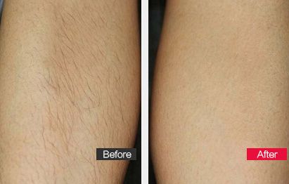 濟南乳房下垂矯正術(shù)推薦診所排行榜