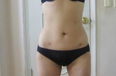 運(yùn)城薛大夫整形美容門(mén)診部值得信賴嗎？為何受到許多人的青睞？