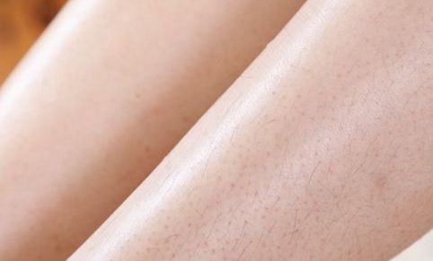 徐州祛雀斑醫(yī)院哪家好？專家解讀TOP10徐州祛斑醫(yī)院推薦